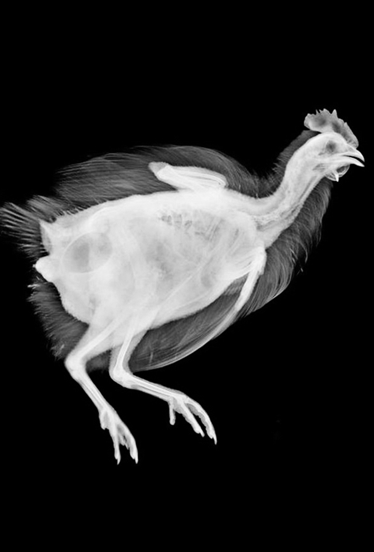 Dijital röntgen tekniği ile kemik sağlığı tespiti